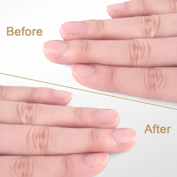 Cuticle%20Nipper%20Set,%20Nail%20Care%20Cuticle%20Cutter%20Trimmer%20and%20Cuticle%20Pusher%20with%20Non-slip%20Protective%20Coating%20Handle%20Stainless%20Steel%20Cuticle%20Cutter%20Clipper%20Durable%20Cuticle%20Nipper%20and%20Remover%20-%20Image%206