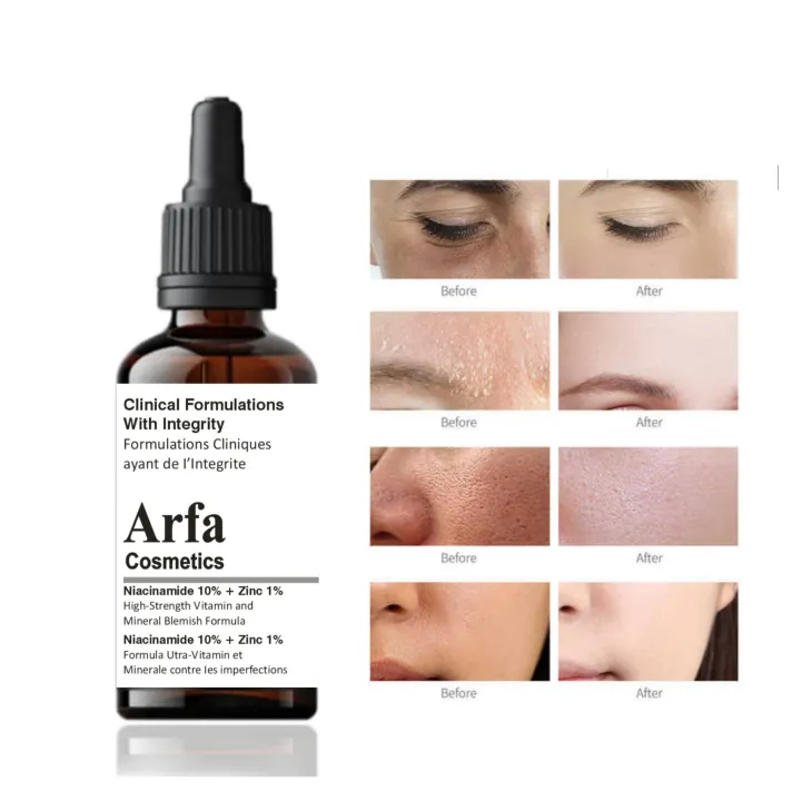 Arfa Cosmetics Premium Niacinamide 10% + Zinc 1%  Glowing Skin Dark Spots Brightening Oil Contro Ser