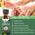 Fast Nail Fungal Treatments Nail Repair Essences Serum Care Treatments Foot Nail Fungus Removal Gel Paronychia Onychomycosis. 