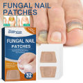 32Pcs Nail Treatment Patch Anti Fungal Nail Correction Stickers Ingrown Toenail Care Paronychia Anti Infection Repair Patch Yao Store. 
