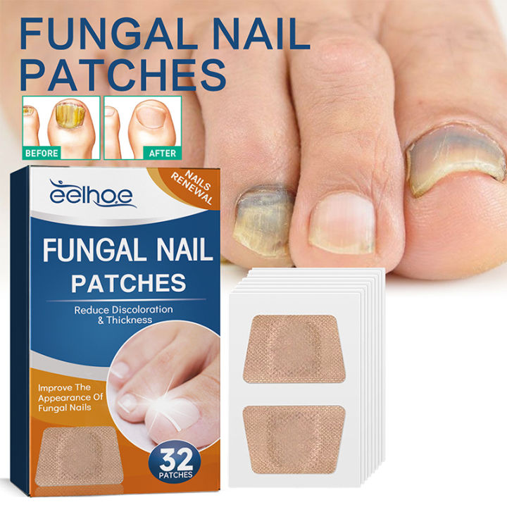 32Pcs Nail Treatment Patch Anti Fungal Nail Correction Stickers Ingrown Toenail Care Paronychia Anti Infection Repair Patch Yao Store