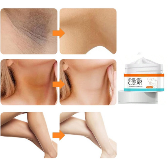 Whitening cream  Underarm for women and men  | Skin lightening cream | Private area whitening | Underarm brightening | Sensitive cream