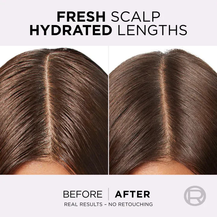 L'Oreal%20Paris%20Elvive%20Hyaluron%20Pure%20Shampoo%20-%20For%20Oily%20Scalp%20175ML%20-%20Image%206