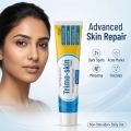 Trimo Skin Cream Skin Care for Face, Scar Removal, Acne, Hand, Foot, and Pigmentation Skin Care Products Freckles Removing Cream For All Skin Types | Skin Care Products. 