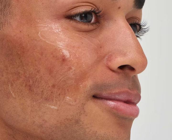 Inkey%20List%20Tranexamic%20Acid%20Serum%2030ml%20-%20100%25%20original%20product%20-%20Image%202