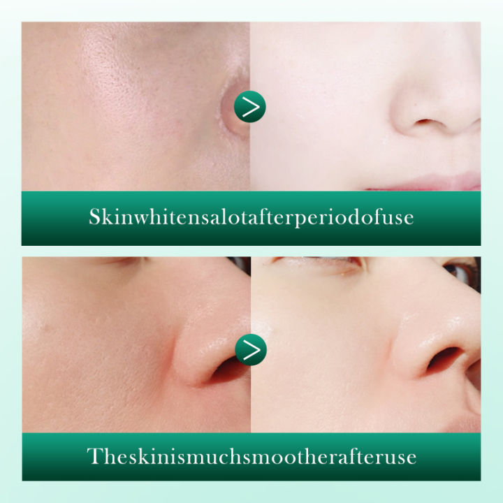 SADOER%20Retinol%20Centella%20Anti%20Wrinkle%20Soothing%20Facial%20Moisturizing%20Liquid%20Skin%20Lightening%20Facial%20Serum%20Essence%2040ml%20SD84427%20-%20Image%204