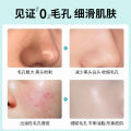 Azelaic Acid Gel Gel Acne Cream Removes AcneGently Brightens Skin Pore Shrinking Serum Improves Large Pores and Blackheads. 