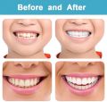 Snap-On Smile Instant Teeth Whitening Snap-On Cosmetic Denture for White Smile Oral Hygiene Accessory. 