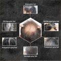 CollapseTen Polygonum Multiflorum Shampoo Soap Darken Hair Color Natural Hair Beard Soap Cover Gray Hair Dye Canas Hair White Hair To Black. 