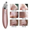 USB Rechargeable Derma Suction 4 in 1 Four Different Levels Suction Blackhead Whitehead Extractor Remover Device Acne Pimple Pore Cleaner... 
