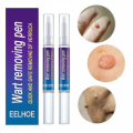Warts Removal Pen Eliminate Wart Pen Wart Liquid Hand Foot Warts Remove Filiform Wart. 