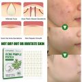 Amnnnesia For JAYSUING Acne Pimple Patch Acne Treatment Stickers Pimple Remover Tool Blemish Spot Skin Care Face Mask Acne Cream Night Use. 