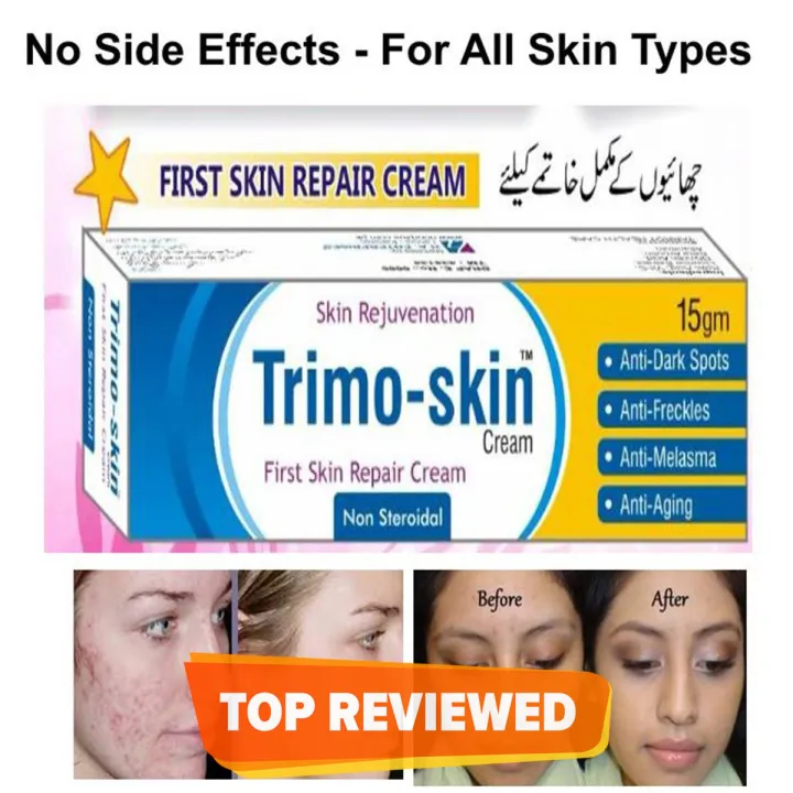 Trimo%20Skin%20Kojic%20Acid%20Skin%20Repair%20Cream%20for%20Face%20Freckles%20Dark%20Spots%20and%20Melasma%20-%20Image%202