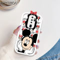 Hontinga for OPPO A5 2020 A9 2020 Back Cover Gift For Girl Phone Case Monster Lens Camera Protection TPU Cover. 