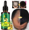 7 Days Hair Growth Oil – Natural Ginger Serum for Fast Hair Regrowth | Anti Hair Fall & Baldness Treatment for Men & Women | Herbal Hair Thickening Solution | Rapid Results in 7 Days – 30ML. 