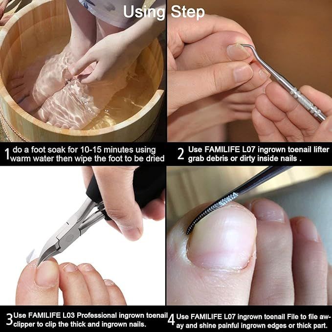 Stainless%20Steel%20Ingrown%20Toenail%20Removal%20Kit%20Pedicure%20Kit%20Ingrown%20Toenail%20File%20and%20Lifter,%20Familife%202pcs%20Ingrown%20Toenail%20Tool%20Double%20Sided%20with%20Storage%20Case%20Professional%20Ingrown%20Toenail%20Corrector%20100%25%20-%20Image%204
