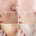 UPTOWN LA  Pore-Refining Treatment Gel (Niacinamide + Witch-hazel)  - 50g. 