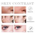 SKIN PERFECTING 2% BHA Liquid Salicylic Acid Exfoliant-Facial Exfoliant Blackheads Acne/Spot Removing Face Serum 30ml. 