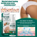 100ml Butt Acne Treatment Cream Clearing Buttock Thigh Acne Bumps Dark Spots Moisturizing Smoothing Hydrating Skin Care. 