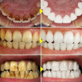 V34 Teeth Whitening Toothpaste Remove Plaque Coffee Stains Cleaning Oral Hygiene Bleaching Dental Tools Fresh Breath Tooth Care. 