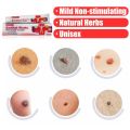 South Moon Wart Removing Ointment Anti Warts Ointment Hands Axillary Meat Particles Neck Filamentous Smooth Wart Remover Cream. 