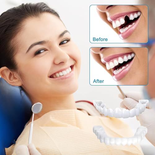 Invisible%20Snap-On%20Teeth%20Veneers%20%7C%20Instant%20Smart%20Smile%20Cover%20for%20Men%20&%20Women%20%7C%20Teeth%20Gap%20&%20Stain%20Corrector%20%7C%20Natural%20White%20Dental%20Braces%20%E2%80%93%20Comfortable%20Fit%20-%20Image%206