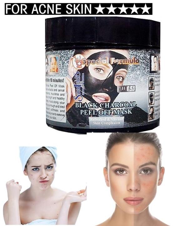 Charcoal%20Acne%20Blackhead%20Peel-Off%20Mask%20For%20Acne%20Skin%20-%20150%20Ml%20-%20Image%206