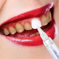 Teeth Whitening Pen For Plaque And Stains Removal. 