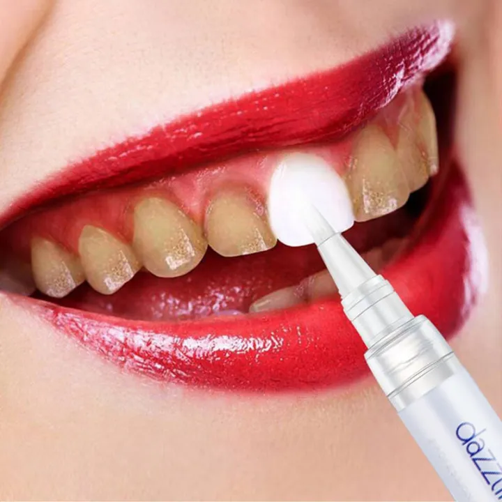 Teeth%20Whitening%20Pen%20For%20Plaque%20And%20Stains%20Removal%20-%20Image%206