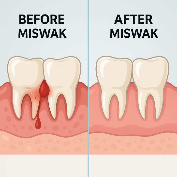 Siwak%20Makkah%203%20Miswak%20Sticks%20with%201%20free%20Miswak%20Natural%20Oral%20Care%20Toothbrush%20Premium%20Quality%20-%20Image%206