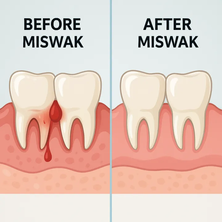 Siwak%20Makkah%203%20Miswak%20Sticks%20with%201%20free%20Miswak%20Natural%20Oral%20Care%20Toothbrush%20Premium%20Quality%20-%20Image%206