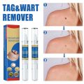 Warts Removal Pen Eliminate Wart Pen Wart Liquid Hand Foot Warts Remove Filiform Warts Flat Warts Condyloma Acuminatum. 