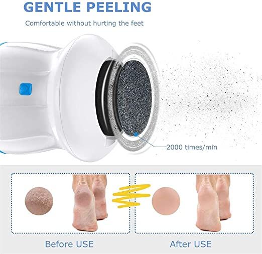 Foot%20Pedicure%20Grinder%20Remover%20Tools%20Electric%20Automatic%20Polisher%20File%20Dead%20Skin%20Callus%20Feet%20Care%20Cleaning%20-%20Image%205