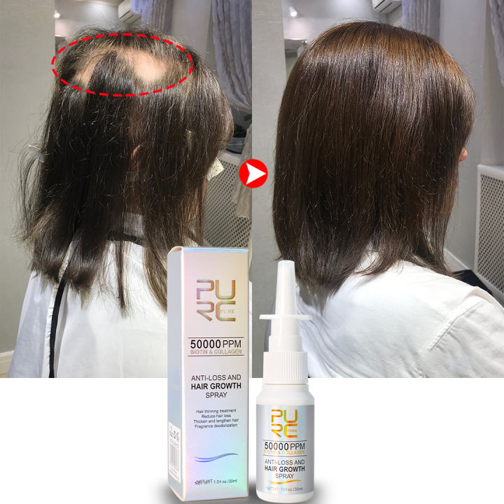 PURC Hair Growth Products for Men Women Biotin Collagen Anti Hair Loss Spray Fast Regrowth Thicken Scalp Treatment Hair Care RuoiasR