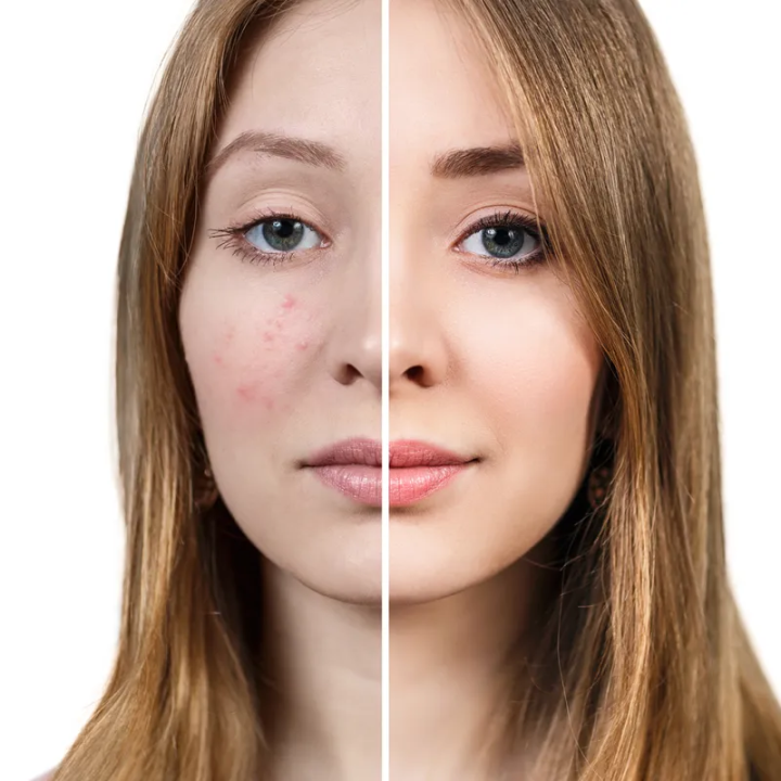 Face%20Fresh%20Gold%20Face%20Wash%20(60ml)%20-%20Image%207