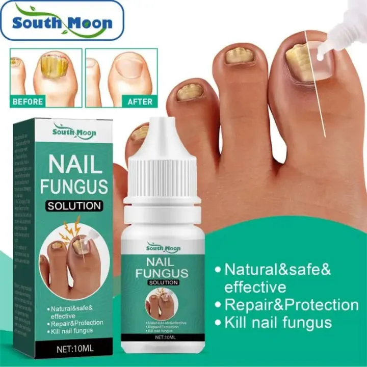 South%20Moon%20Premium%20Nail%20Fungus%20Treatment%20Serum%20-%20Effective%20Nail%20Repair%20&%20Protection%20for%20Onychomycosis%20-%20Image%2010