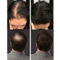 Dexe Hair Building Fiber for Thickening and Concealing - Hair Regrowth Powder Keratin Hair Fiber. 