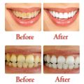Baking Soda Toothpaste Stain Removal Teeth Whitening Toothpaste Fight Bleeding Gums Passion Fruit Toothpaste Cleaning Oral Care. 
