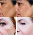 Pack of 3 Trimoskin Cream With Hand & Feet Whitening Cream With ClobeWhite ━━ 𝙏𝙧𝙞𝙢𝙤𝙨𝙠𝙞𝙣 ━━ for Skin Whitening Moisturizer Best Freckles / Spots Removal. 