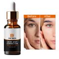 Dark Spot serum (Face Fade serum) Niacinamide 10% 30ml. 