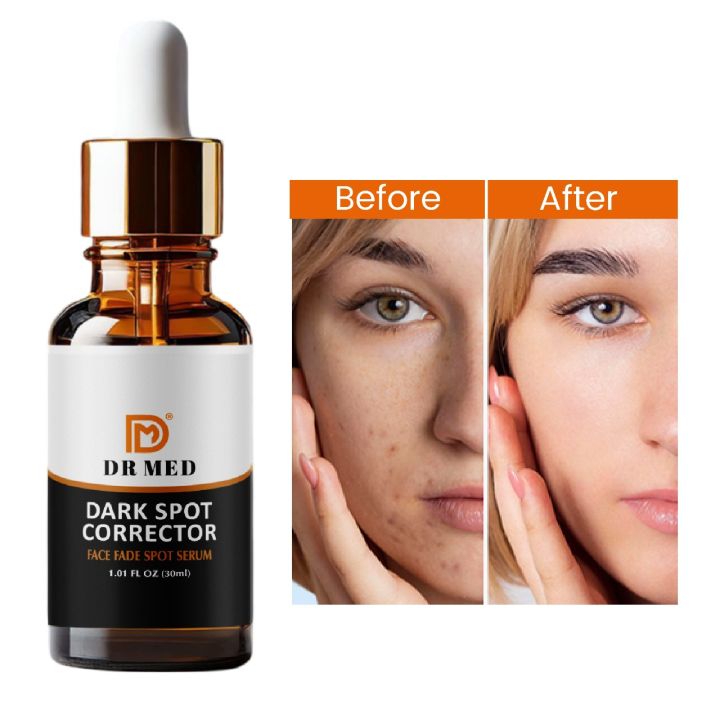 Dark%20Spot%20serum%20(Face%20Fade%20serum)%20Niacinamide%2010%25%2030ml%20-%20Image%202