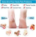 Silicone Gel Heel Pad Socks For Pain Relief And Anti Crack Heel 1 Pair Heel Cups Heel Guards Heel Protectors Heel Sleeves For Relieve Heel Pads Cushion Heel Pain, Heal Dry Cracked Heels, Achilles Tendinitis, For Men & Women. 