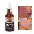 Hyaluronic Acid serum: Deep hydration - hyaluronic 1.5% 30ml. 