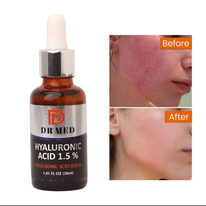 Hyaluronic%20Acid%20serum:%20Deep%20hydration%20-%20hyaluronic%201.5%25%2030ml%20-%20Image%207
