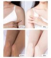 whitening cream full body Bikini private parts underarm girl woman. 