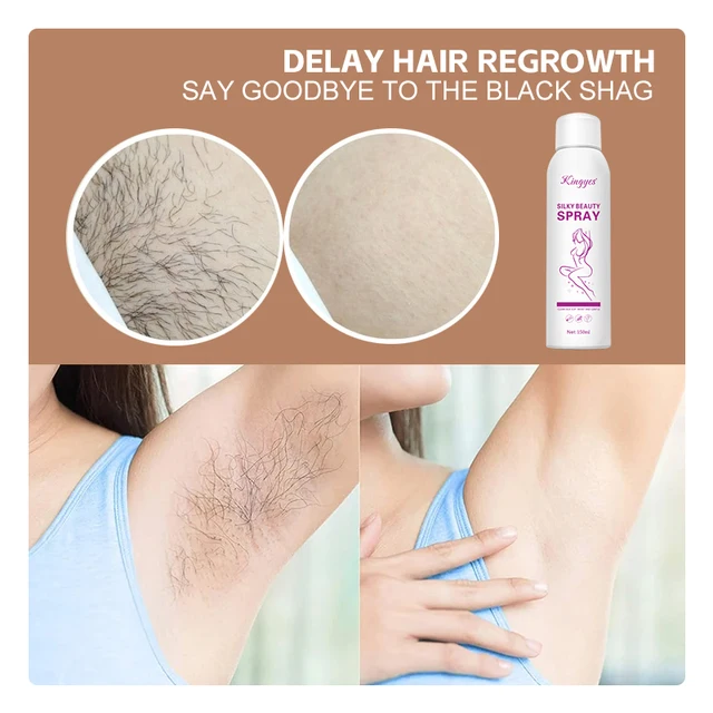 Kingyes%20Silky%20Beauty%20Hair%20Removal%20Spray%20-%20Removes%20Hair%20From%20The%20Roots%20-%20Hair%20Removal%20Without%20Side%20Effects%20-%20Hand%20And%20Foot%20Hair%20Remover%20-%20Kingyes%20Hair%20Removal%20Spray%20-%20Image%204