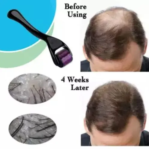 Derma%20Roller%201mm%20Skin%20Therapy%20Micro-Needle%20540%20For%20Acne%20Scars%20Wrinkles%20Stretch%20&%20Pores%20-%20Image%203