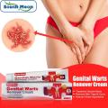 South Moon Wart Removing Ointment Anti Warts Ointment Hands Axillary Meat Particles Neck Filamentous Smooth Wart Remover Cream. 