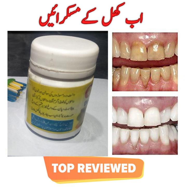 100% Natural Herbal Homeo Tooth Powder (Teeth Manjan) Dental Remedy Teeth Whitening No Side Effect