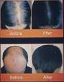 PEI MEI REPAIR HAIR ANTI-FRIZZ &HAIR GROWTH ESSENTIAL OIL 30ML. 